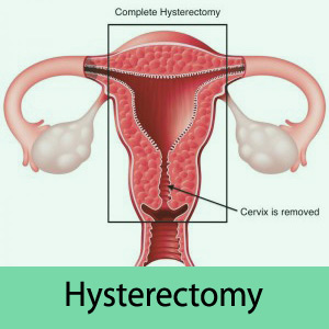  هیسترکتومی، عمل جراحی برداشتن رحم چیست؟