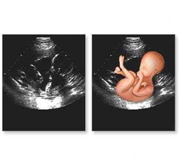 آزمایش های معمول در بارداری