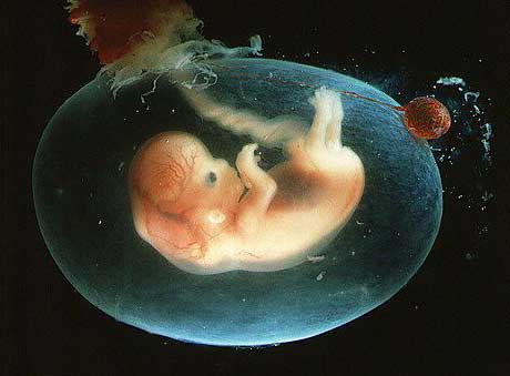 تغییرات مایع آمنیون (مایع درون کیسه جنین) در دوران بارداری