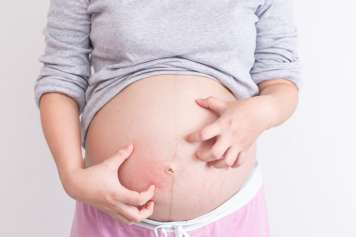 علت خارش شکم در بارداری