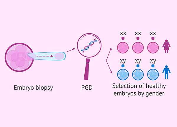 مزایا و معایب PGD جهت تعیین جنسیت جنین و بررسی نقایص ژنتیکی