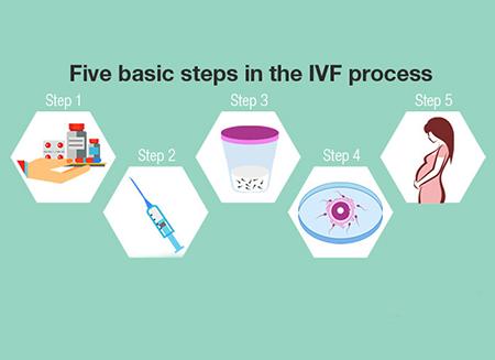 لقاح آزمایشگاهی (ivf)