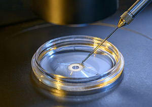 درمان ناباروری با روش IVM یا بالغ کردن تخمک در آزمایشگاه