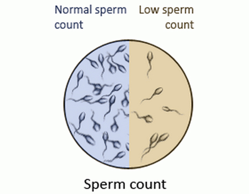 آیا تعداد کم اسپرم باعث ناباروری می شود؟