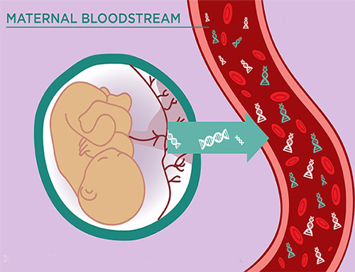 تست NIPT یا  تست غربالگری غیر تهاجمی پیش از تولد 