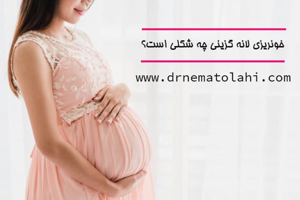 خونریزی لانه گزینی چه شکلی است؟