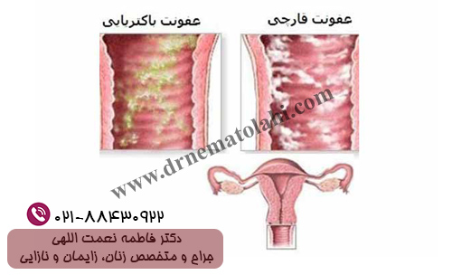 نازایی و عفونت‌های تناسلی