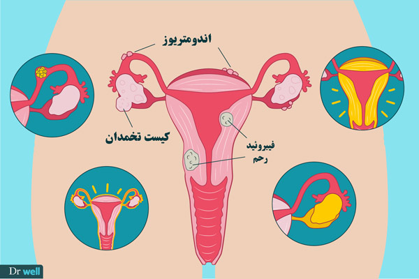 با مشاهده این علائم به متخصص زنان مراجعه کنید