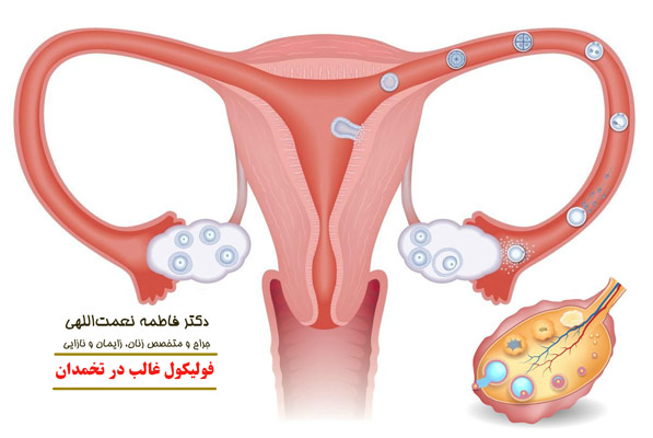 فولیکول غالب در تخمدان