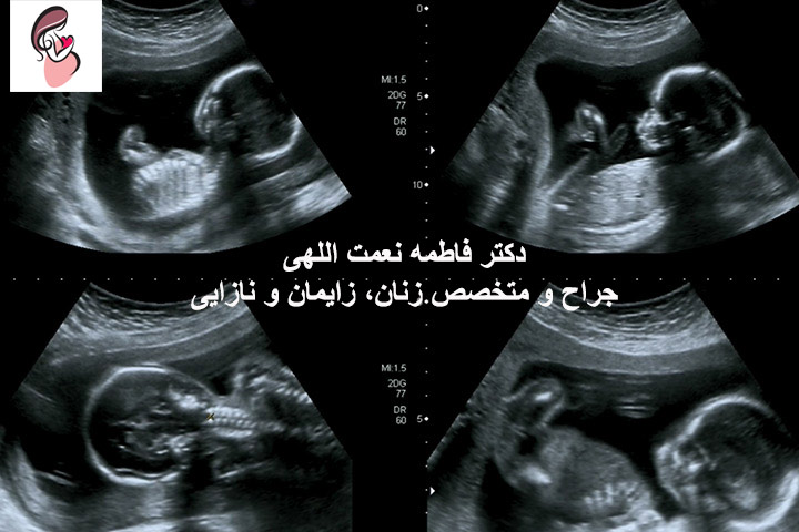 سونوگرافی در ۳ ماه اول و سوم بارداری 