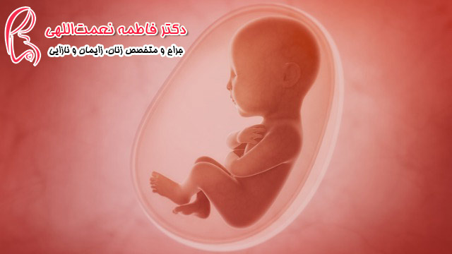 پلی‌هیدرامنیوس یا افزایش بیش از حد مایع دور جنین