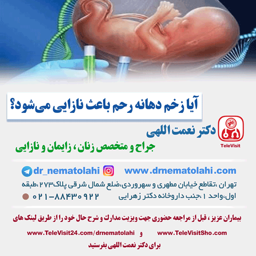 آیا زخم دهانه رحم باعث نازایی می‌شود؟