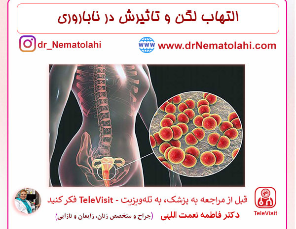 التهاب لگن و تاثیرش در ناباروری