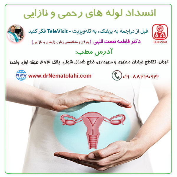 انسداد لوله های رحمی و نازایی