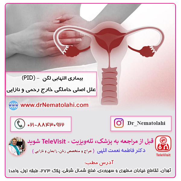 PID، علل اصلی حاملگی خارج رحمی و نازایی