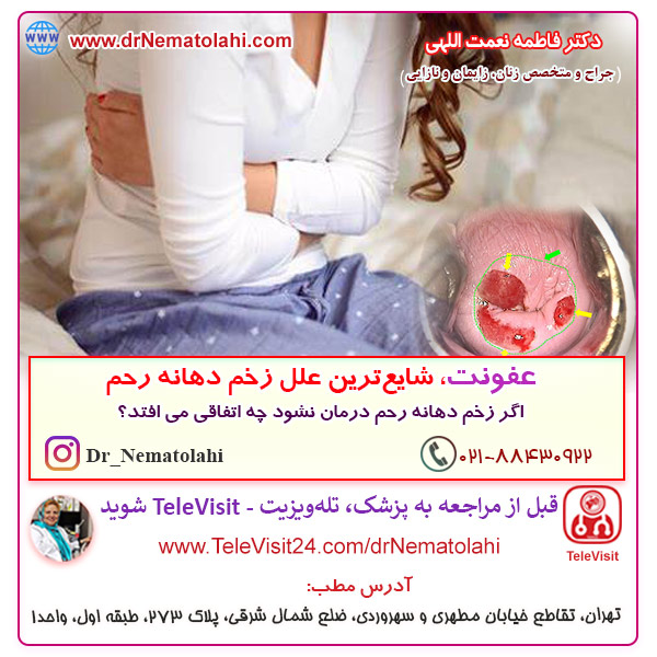 عفونت، شایع ترین علل زخم دهانه رحم