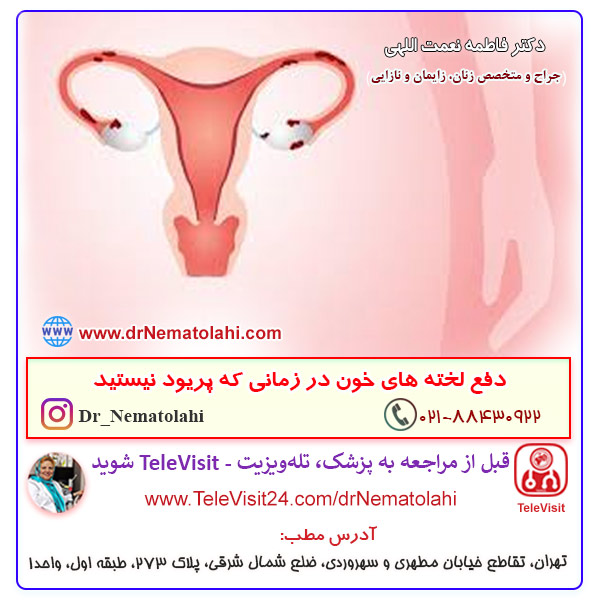 دفع لخته های خون در زمانی که پریود نیستید