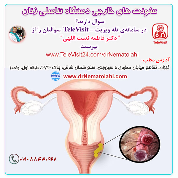 عفونت های خارجی دستگاه تناسلی زنان