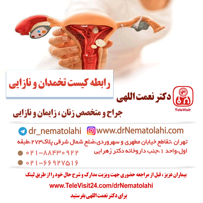 رابطه کیست تخمدان و نازایی