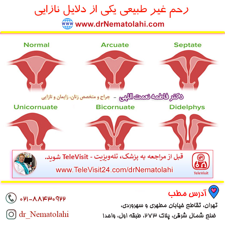 رحم غیر طبیعی یکی از دلایل نازایی