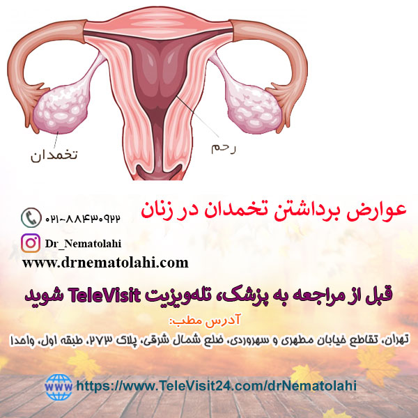 عوارض برداشتن تخمدان در زنان