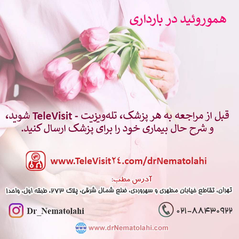 هموروئید در بارداری
