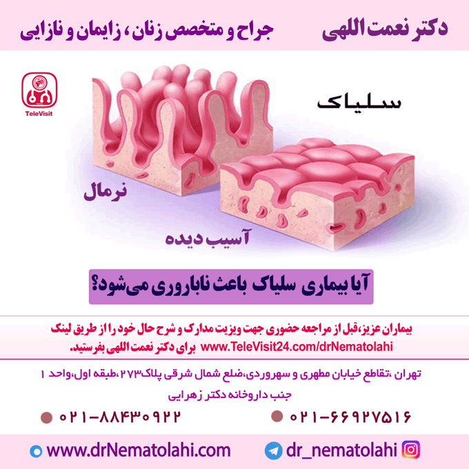 آیا بیماری سلیاک باعث ناباروری می‌شود؟ بررسی علمی رابطه سلیاک و ناباروری