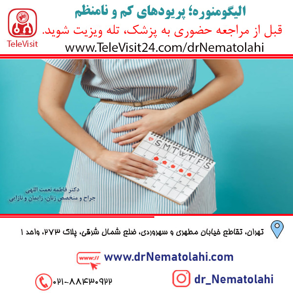 الیگومنوره؛ پریودهای کم و نامنظم
