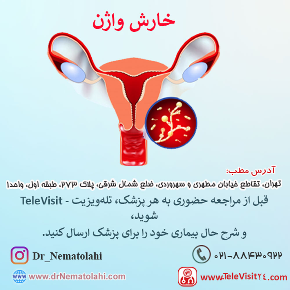خارش واژن