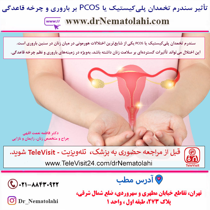 تأثیر سندرم تخمدان پلی‌کیستیک - PCOS بر باروری و چرخه قاعدگی