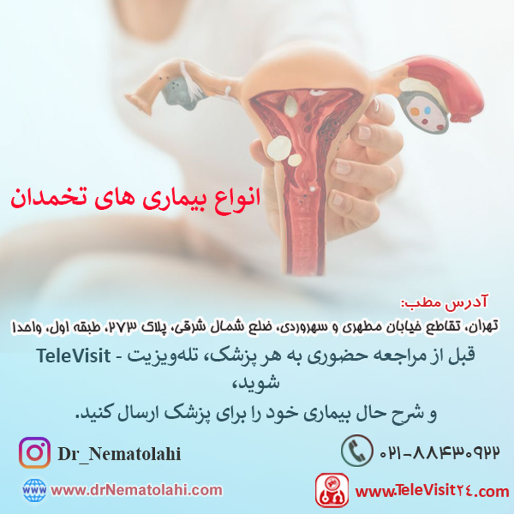انواع بیماری‌ های تخمدان