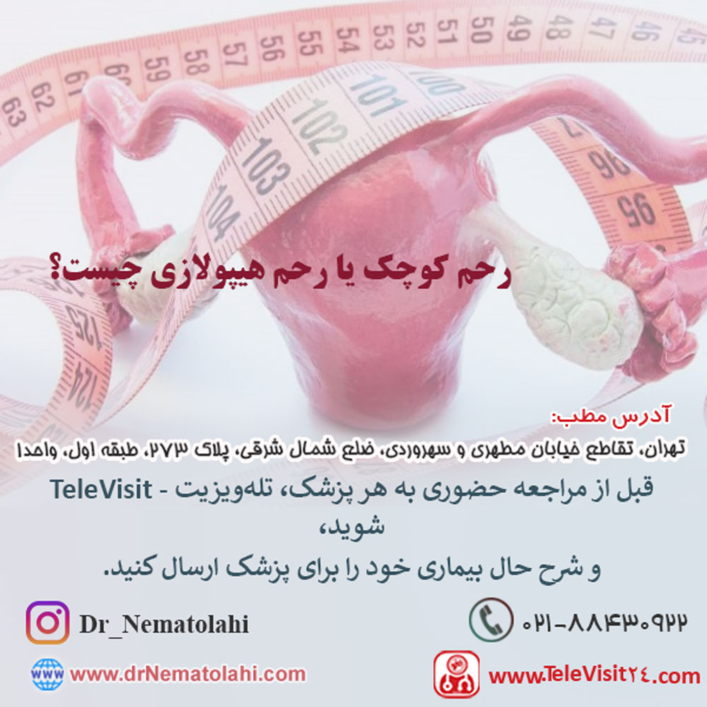رحم کوچک یا رحم هیپولازی چیست؟