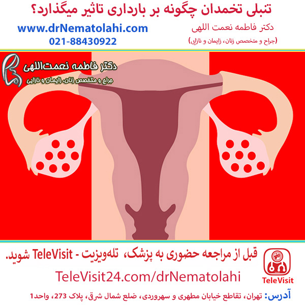 تنبلی تخمدان چگونه بر بارداری تاثیر میگذارد؟