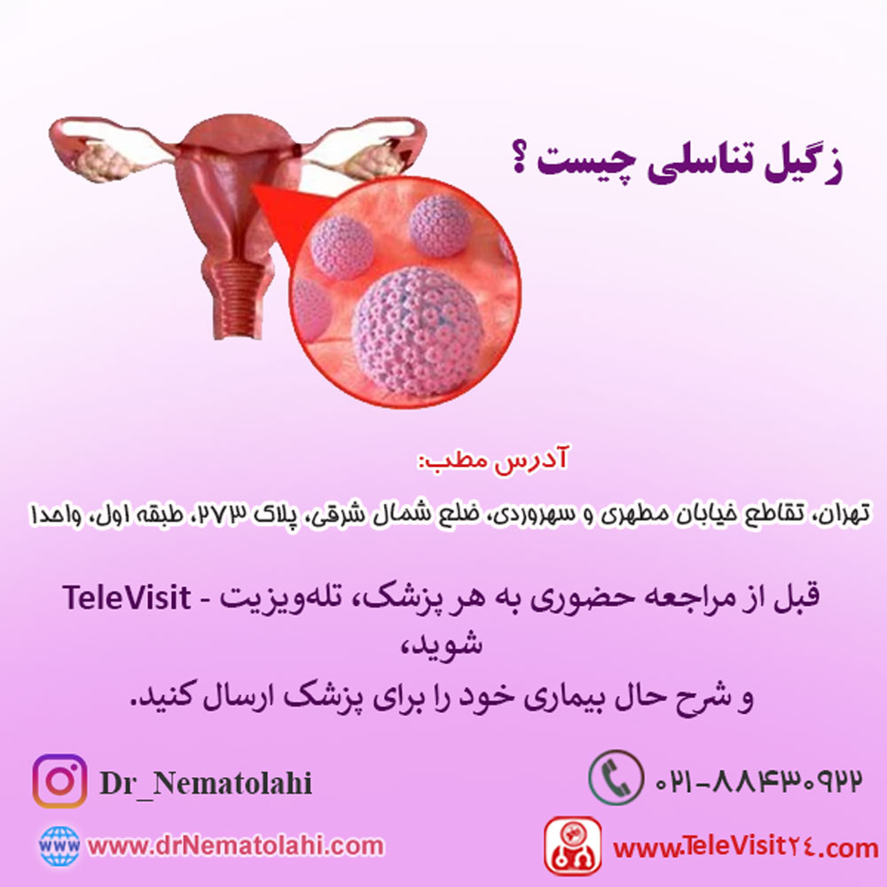 زگیل تناسلی چیست