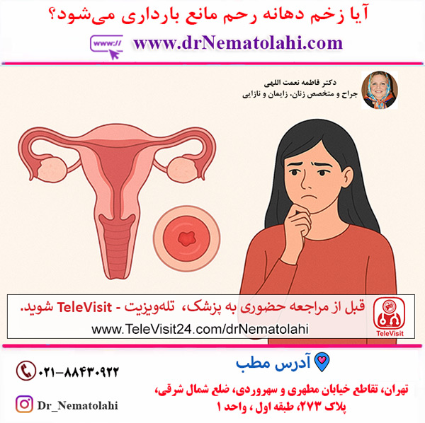 آیا زخم دهانه رحم مانع بارداری می‌شود؟