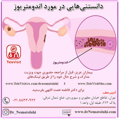 دانستنی هایی در مورد اندومتریوز