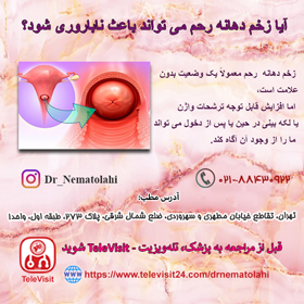 آیازخم دهانه رحم می تواند باعث ناباروری شود؟