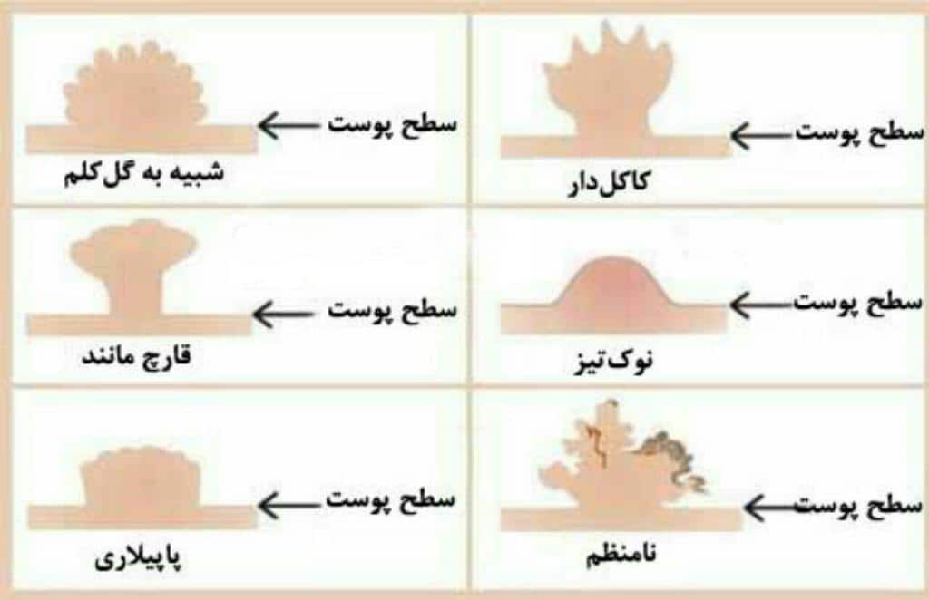 دکتر فاطمه نعمت اللهی،جراح و متخصص زنان و زایمان،توده های دستگاه تناسلی